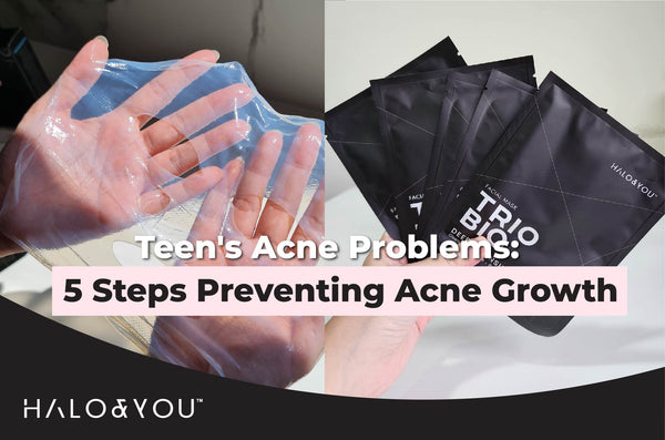 prevent acne halo and you trio bio deep cleansing facial mask